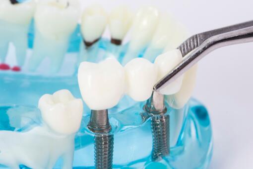 当事医院回应男子拔智齿后死亡