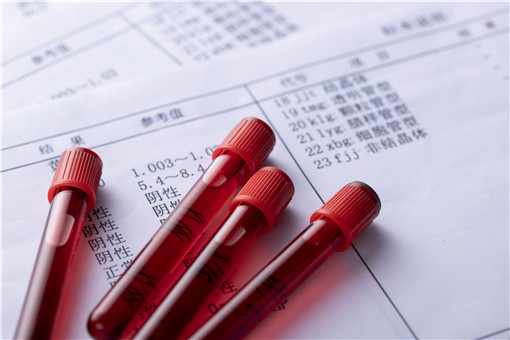 血奴是什么意思 血奴和血仆的区别具体在哪 土流网
