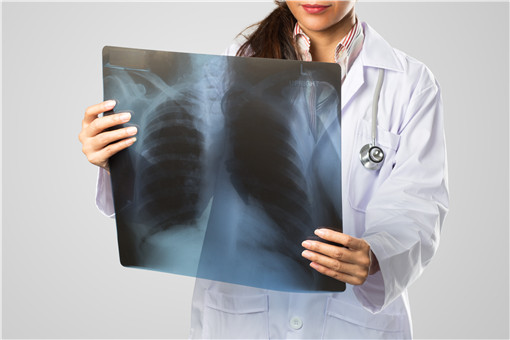 肺部CT需求暴增 檢出率約10%-20%！是怎么一回事？